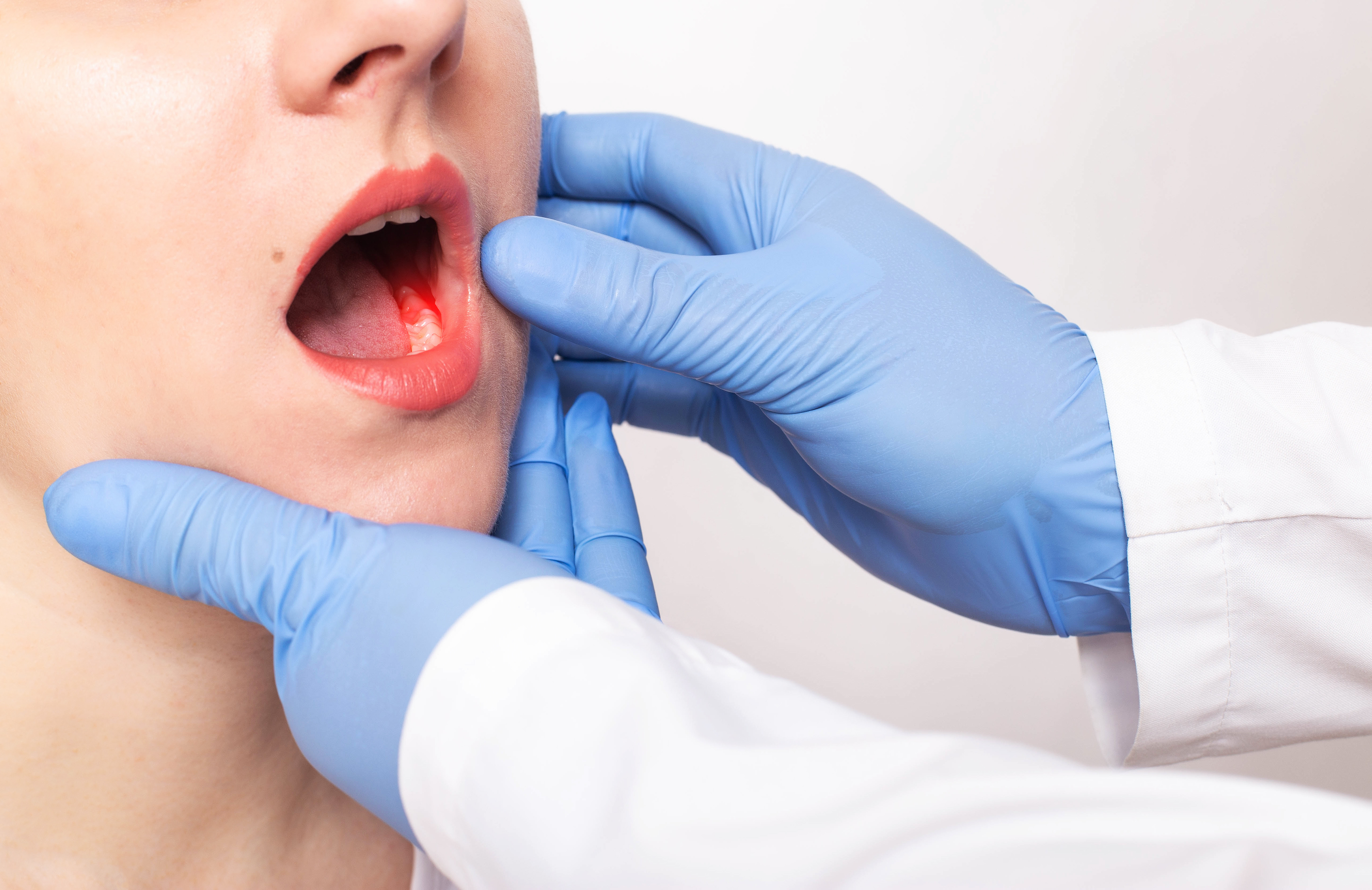 Полость рта профилактика лечение