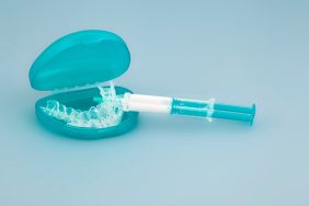 A Look At Two Teeth Whitening Options