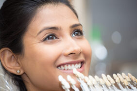 Veneers Could Offer An Attractive Smile  