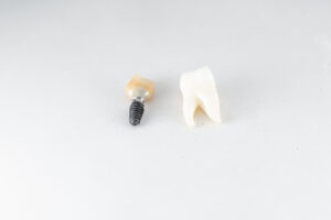 rowlett dental implants