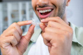 Straightening Teeth With Invisalign® Aligners