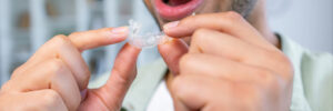 rowlett invisalign