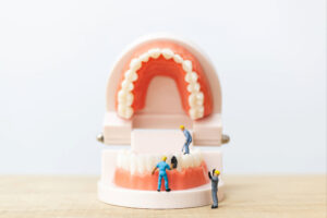 rowlett dental bonding