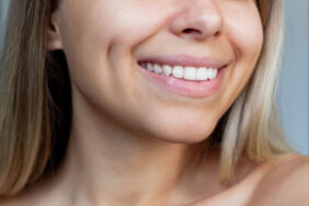 Two Ways To Whiten Your Smile