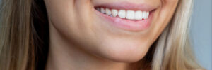 rowlett teeth whitening